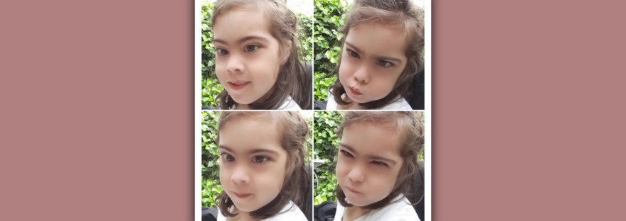 imagen de niña sindrome de down con varias expresiones emocionales