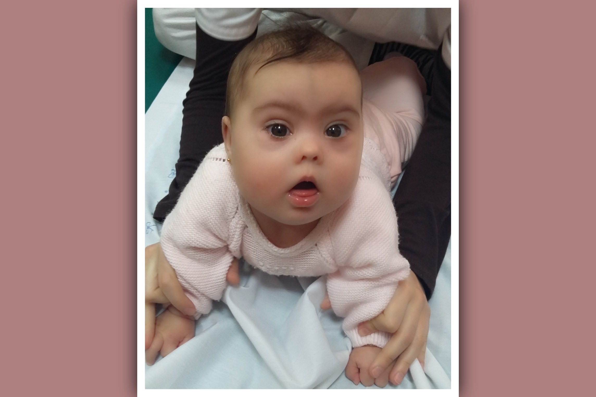 sesion de fisioterapia en bebe con sindrome de down