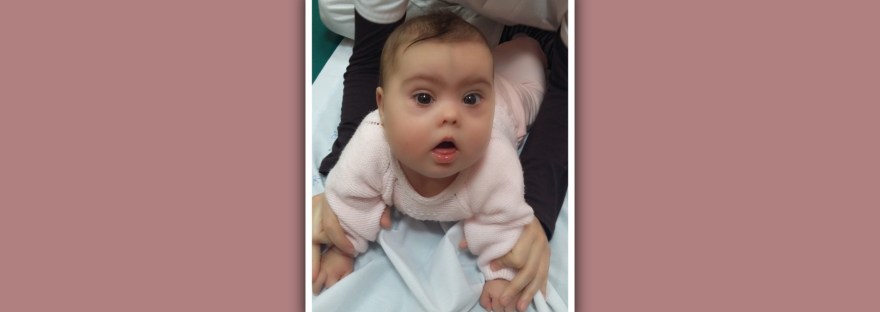 sesion de fisioterapia en bebe con sindrome de down