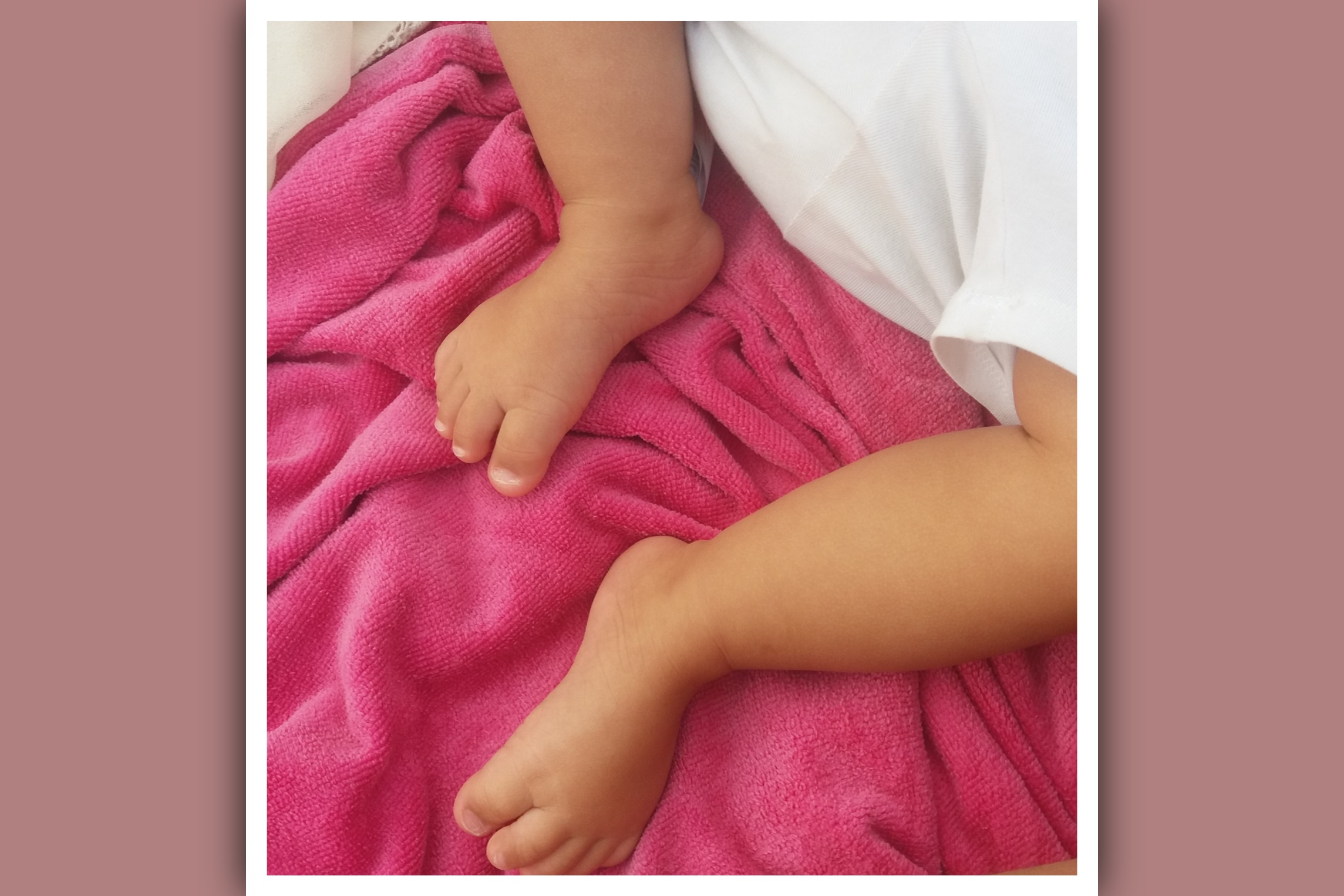 imagen de pies niña con sindrome de down