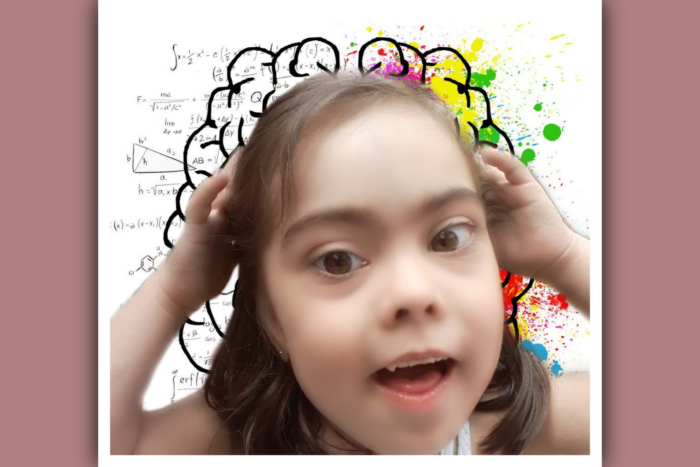 imagen de hemisferios cerebrales en una niña con sindrome de down