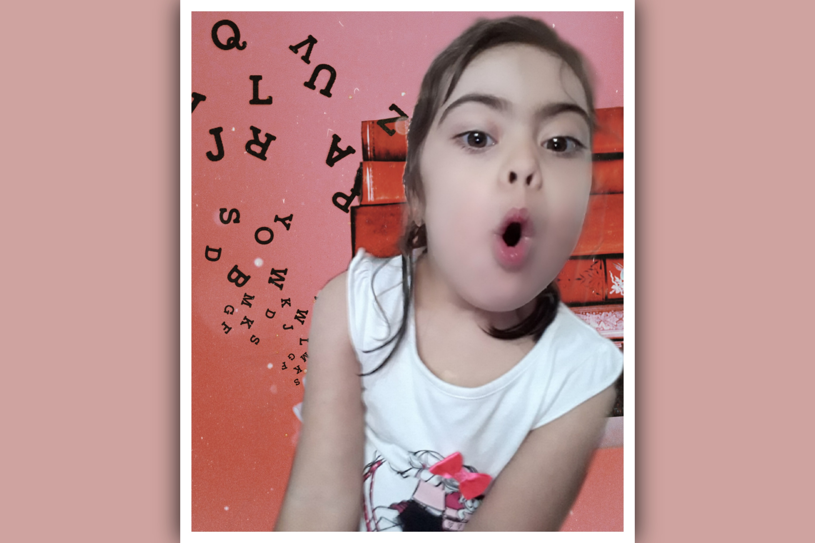 imagen de niña con sindrome de down en referencia a tartamudez