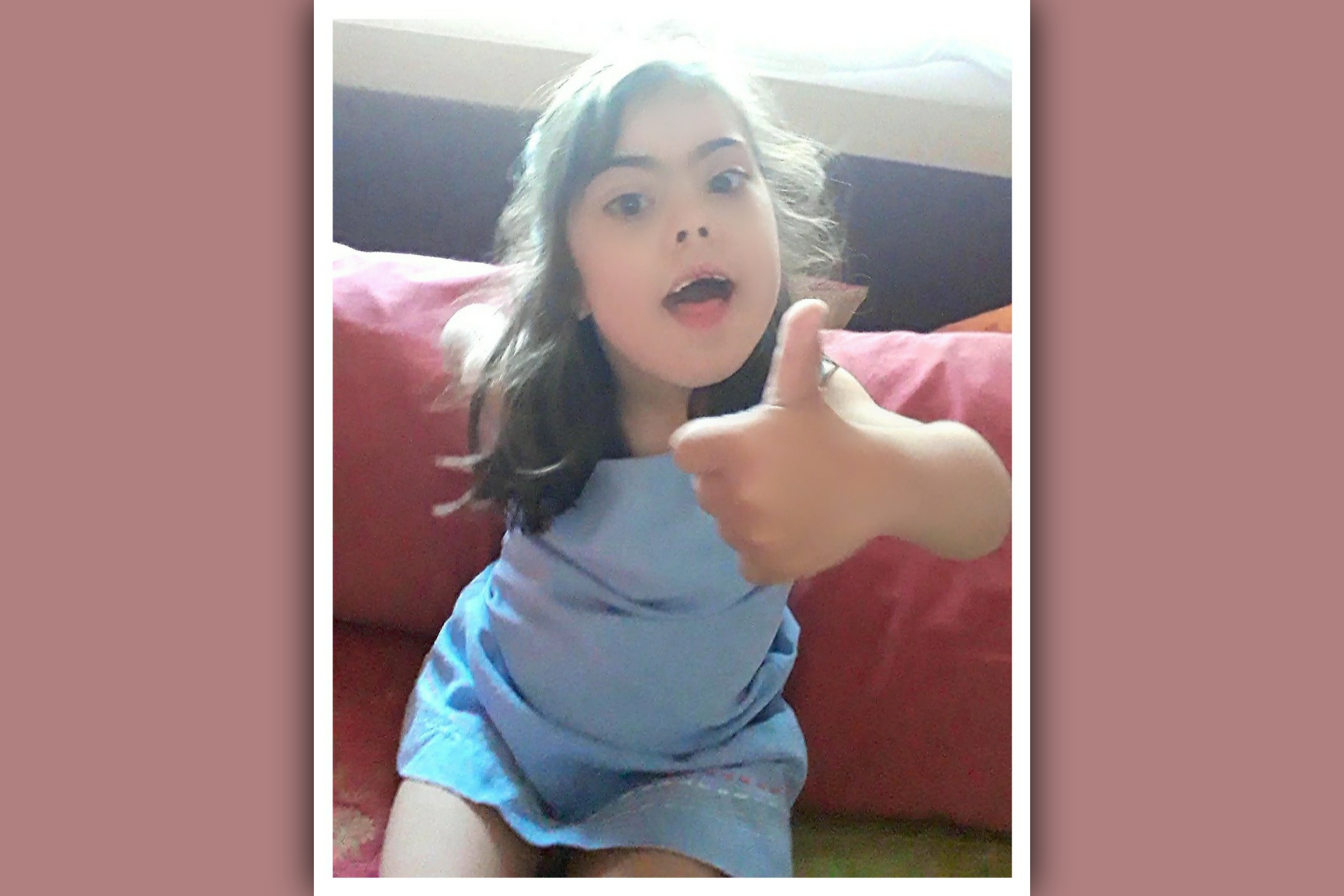 imagen de niña con sindrome de down con el pulgar hacia arriba