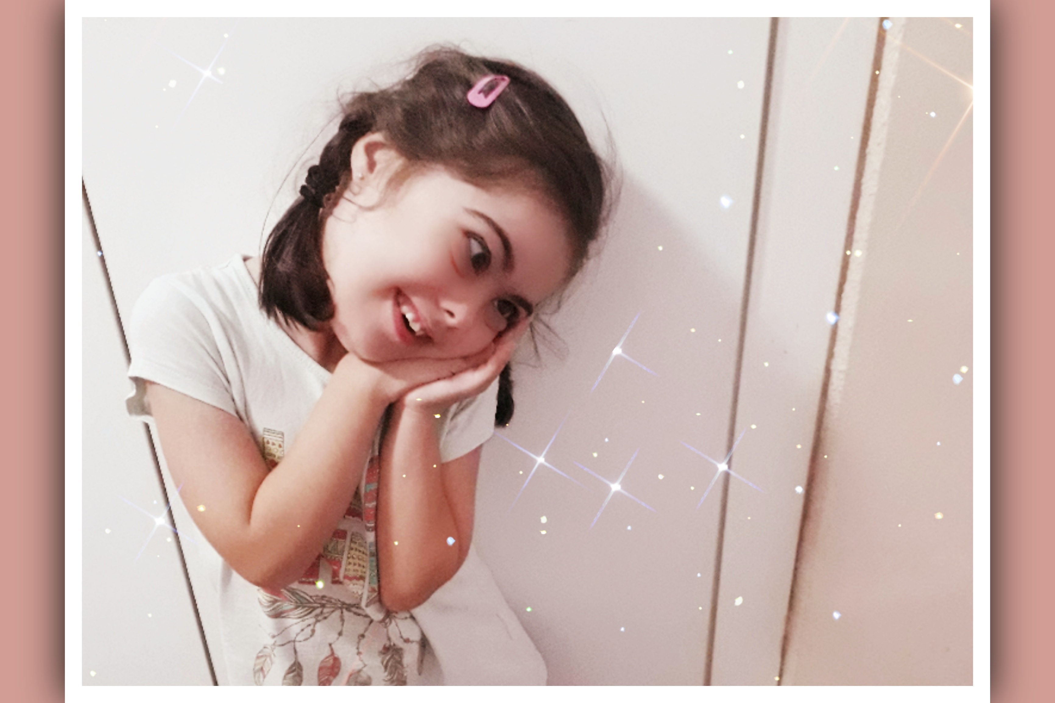imagen niña con sindrome de down con cara de angel